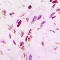 19 - Anti-p53 (Acetyl-K319) Antibody AP60409