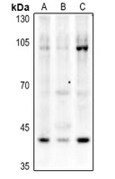 1 - Anti-p53 (Acetyl-K319) Antibody AP60409