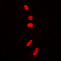 3 - Anti-p53 (Acetyl-K381) Antibody AP60410