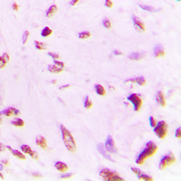19 - Anti-p53 (Acetyl-K381) Antibody AP60410