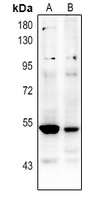 1 - Anti-p53 (Acetyl-K381) Antibody AP60410