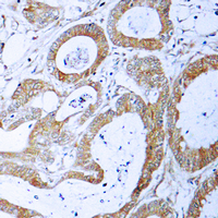 19 - Anti-TRADD Antibody AP60411