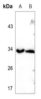 1 - Anti-TRADD Antibody AP60411