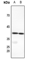 1 - Anti-FX Antibody AP60413