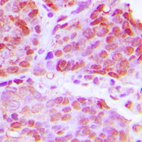 19 - Anti-TTF1 Antibody AP60414