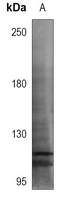 1 - Anti-TTF1 Antibody AP60414