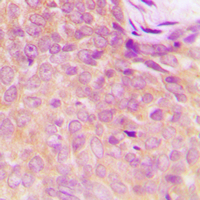 19 - Anti-UBA5 Antibody AP60415