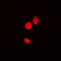 3 - Anti-VDR (Phospho-S208) Antibody AP60416