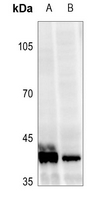 1 - Anti-VDR (Phospho-S208) Antibody AP60416