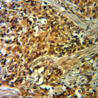 19 - Anti-VIPR1 Antibody AP60417
