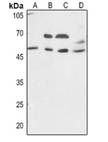 1 - Anti-VIPR1 Antibody AP60417