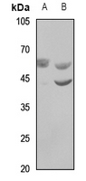 1 - Anti-WASF3 Antibody AP60418