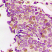 19 - Anti-PS1D Antibody AP60419