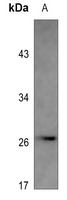 1 - Anti-PS1D Antibody AP60419