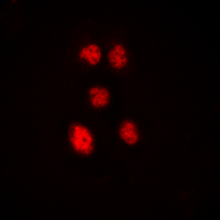 3 - Anti-ZNF148 Antibody AP60420