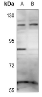 1 - Anti-ZNF148 Antibody AP60420