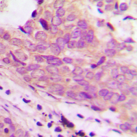 19 - Anti-MARCH1 Antibody AP60421