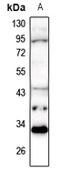 1 - Anti-MARCH1 Antibody AP60421