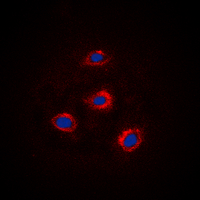 3 - Anti-Alpha-adducin Antibody AP60422