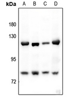 1 - Anti-Alpha-adducin Antibody AP60422