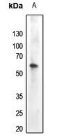 1 - Anti-AKT (Phospho-Y474) Antibody AP60423