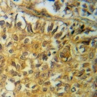 19 - Anti-PRAS40 (Phospho-T246) Antibody AP60424