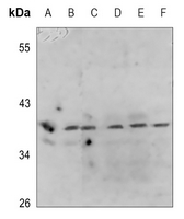 1 - Anti-PRAS40 (Phospho-T246) Antibody AP60424