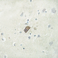 19 - Anti-ARMCX1 Antibody AP60426