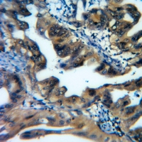 19 - Anti-ATG16L1 Antibody AP60427