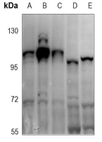 1 - Anti-ATP1A1 (Phospho-S16) Antibody AP60429