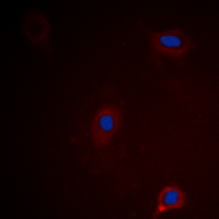 3 - Anti-Ataxin 1 (Phospho-S775) Antibody AP60430