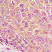 19 - Anti-Ataxin 1 (Phospho-S775) Antibody AP60430