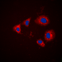 3 - Anti-Aurora A (Phospho-T288) Antibody AP60431