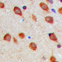 19 - Anti-Aurora A (Phospho-T288) Antibody AP60431