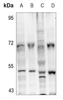 1 - Anti-Aurora A (Phospho-T288) Antibody AP60431