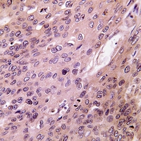 19 - Anti-BMP6 Antibody AP60434