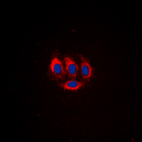 3 - Anti-BMX (Phospho-Y566) Antibody AP60435