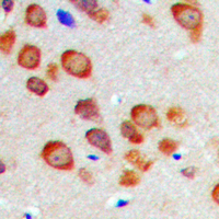 19 - Anti-CABP7 Antibody AP60436
