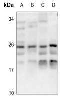 1 - Anti-CABP7 Antibody AP60436