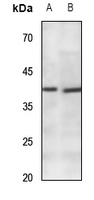 1 - Anti-CACNG7 Antibody AP60437