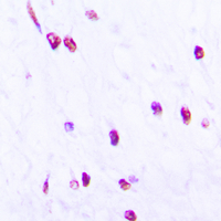 19 - Anti-CDC25C (Phospho-S216) Antibody AP60438