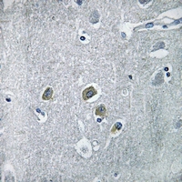 19 - Anti-CDC42EP5 Antibody AP60439