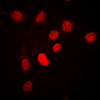 3 - Anti-C/EBP beta (Phospho-T235) Antibody AP60441
