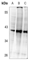 1 - Anti-C/EBP beta (Phospho-T235) Antibody AP60441