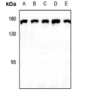 1 - Anti-CLASP1 Antibody AP60442