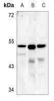 1 - Anti-CLN5 Antibody AP60443