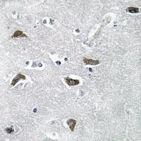 19 - Anti-Collagen 11 alpha 2 Antibody AP60444