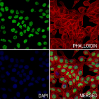 3 - Anti-CPT1B Antibody AP60445