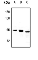 1 - Anti-CPT1B Antibody AP60445