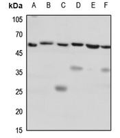 1 - Anti-CD184 Antibody AP60446